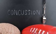 Understanding Concussions